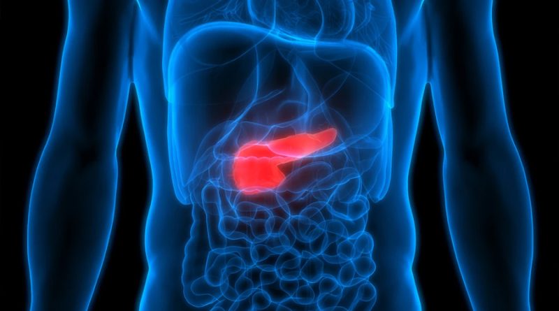 Investigadores descubren marcadores para predecir si el cáncer de páncreas se extenderá a otros órganos
