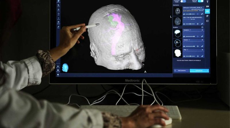 Neurólogos descubren cómo el cerebro se engaña a sí mismo para aliviar el dolor